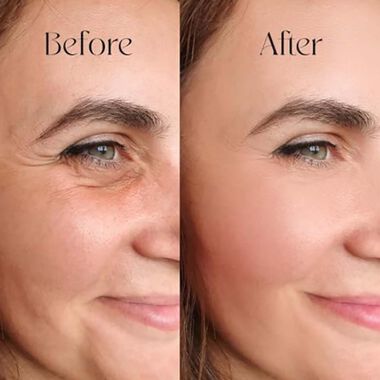 faces hyaluronic acid serum
