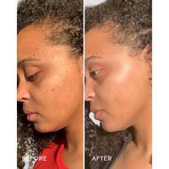 Superfruit Lactic plus Multifruit 8 AHA Exfoliating Mask faces superfruit lactic plus multifruit 8 aha exfoliating mask