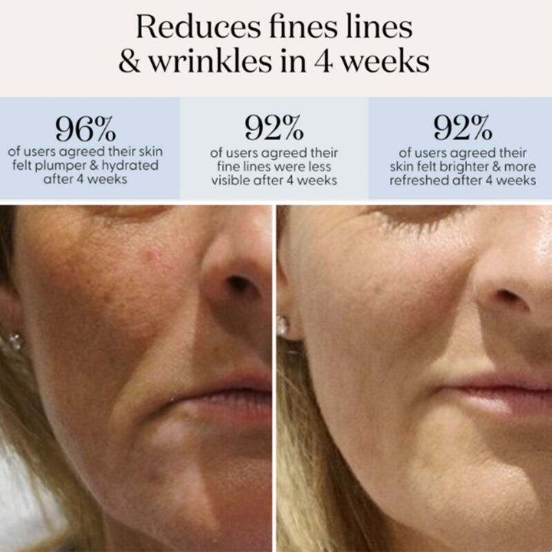 smoothskin dlux redlight led mask