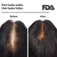 PowerFlex 272 Hair Growth Laser Light Cap faces powerflex 272 hair growth laser light cap