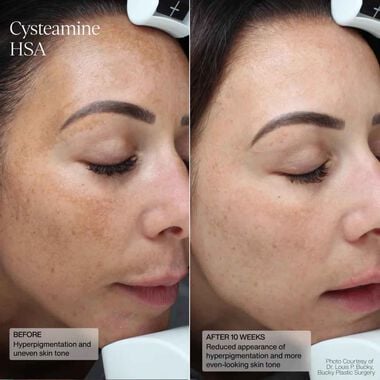 faces cysteamine hsa pigment and tone corrector