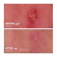 faces cicaplast baume b5 healing balm