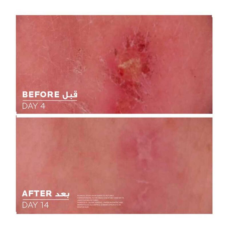 la roche posay cicaplast baume b5 healing balm