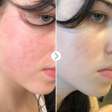 faces زيت الوجه ذا لايت فانتاستك