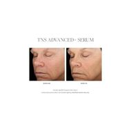 faces سيروم ادفانسيد تي ان اس