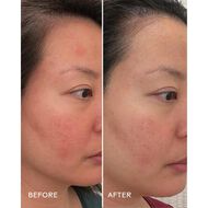faces replenish ceramides plus blueberry barrier repair serum