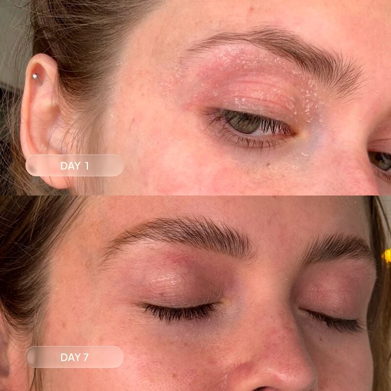 blue skincare repair duo