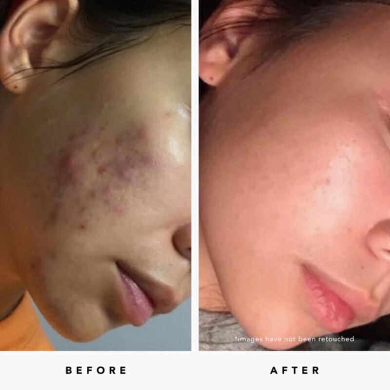 هيربيفور قناع بلو تانسي