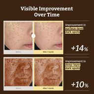 All Advanced Retino-Mela Serum faces all advanced retino mela serum